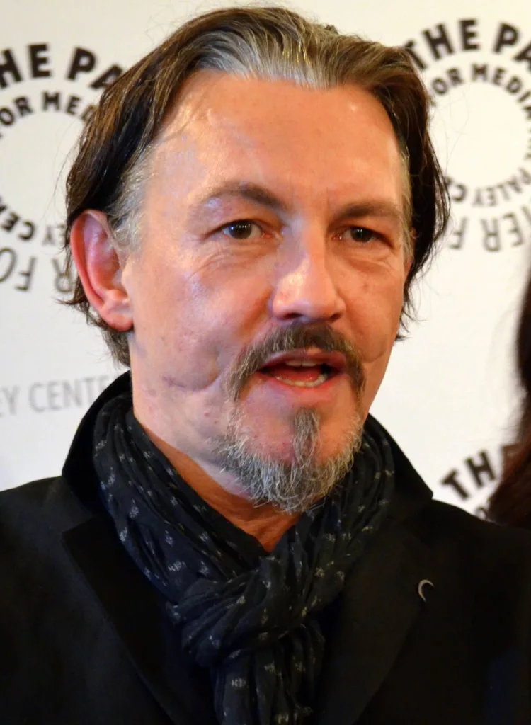 Portrait of a man with visible facial scars associated with a Glasgow smile