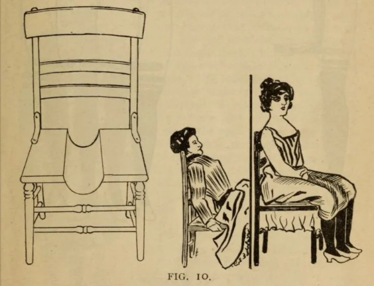 Blanche Dumas - anatomical diagram of a woman with three legs illustrating dipygus condition