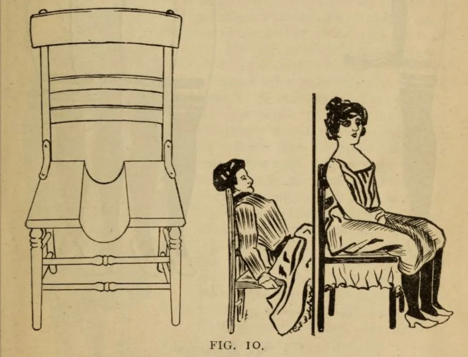 Blanche Dumas - anatomical diagram of a woman with three legs illustrating dipygus condition